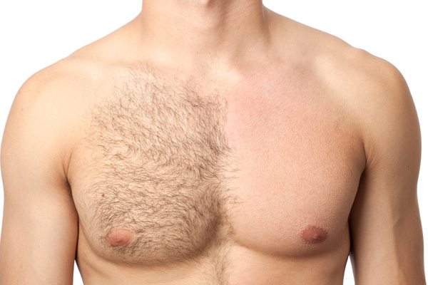 How to Avoid Ingrown Hairs After Male Waxing